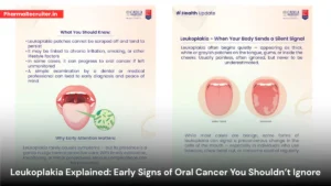 Leukoplakia Explained - Early Signs of Oral Cancer You Shouldn’t Ignore