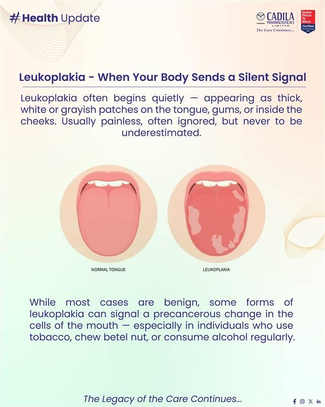 Early Signs, Risk Factors, and Proactive Prevention